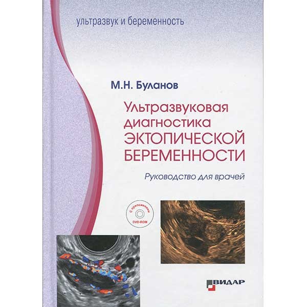 Ультразвуковая диагностика эктопической беременности. Руководство для врачей - Буланов М. Н.