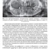 ​Пример страницы из книги "Рентгенология в стоматологии: руководство для врачей" - Аржанцев А. П.
