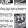 ​Пример страницы из книги "Рентгенология в стоматологии: руководство для врачей" - Аржанцев А. П.
