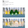 Пример страницы из книги "Создание каркасов несъемных зубных протезов" - Джон Несс
