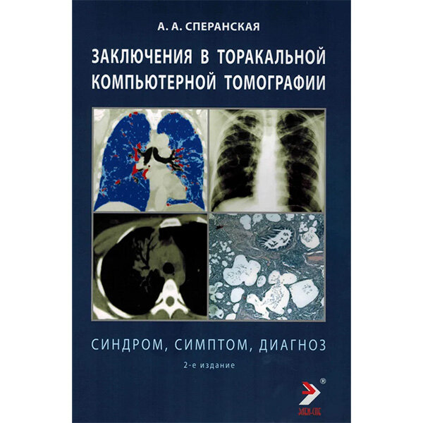 Заключения в торакальной компьютерной томографии. Симптом, синдром, диагноз - Сперанская А. А.