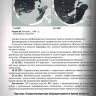 ​Пример страницы из книги "Заключения в торакальной компьютерной томографии. Симптом, синдром, диагноз" - А. А. Сперанская 