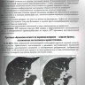 ​Пример страницы из книги "Заключения в торакальной компьютерной томографии. Симптом, синдром, диагноз" - А. А. Сперанская 
