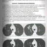 ​Пример страницы из книги "Заключения в торакальной компьютерной томографии. Симптом, синдром, диагноз" - А. А. Сперанская 