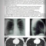 ​Пример страницы из книги "Заключения в торакальной компьютерной томографии. Симптом, синдром, диагноз" - А. А. Сперанская 