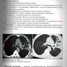 ​Пример страницы из книги "Заключения в торакальной компьютерной томографии. Симптом, синдром, диагноз" - А. А. Сперанская 