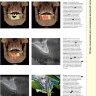 Пример страницы из книги "Профессиональная визуализация в дентальной имплантации" -  Дания Тамими