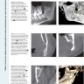 Пример страницы из книги "Профессиональная визуализация в дентальной имплантации" -  Дания Тамими