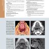 Пример страницы из книги "Лучевая диагностика. Голова и шея" - Кох Б. Л., Гамильтон Б. Э., Хаджинс П. А., Харнсбергер Х. Р.