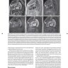 Пример страницы из книги "Лучевая диагностика заболеваний органов грудной клетки" - Субба Р. Дигумарти