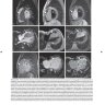 Пример страницы из книги "Лучевая диагностика заболеваний органов грудной клетки" - Субба Р. Дигумарти