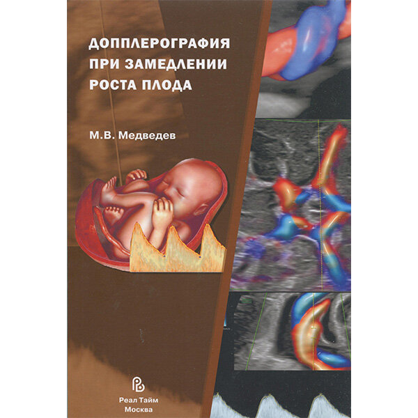 Допплерография при замедлении роста плода - М. В. Медведев